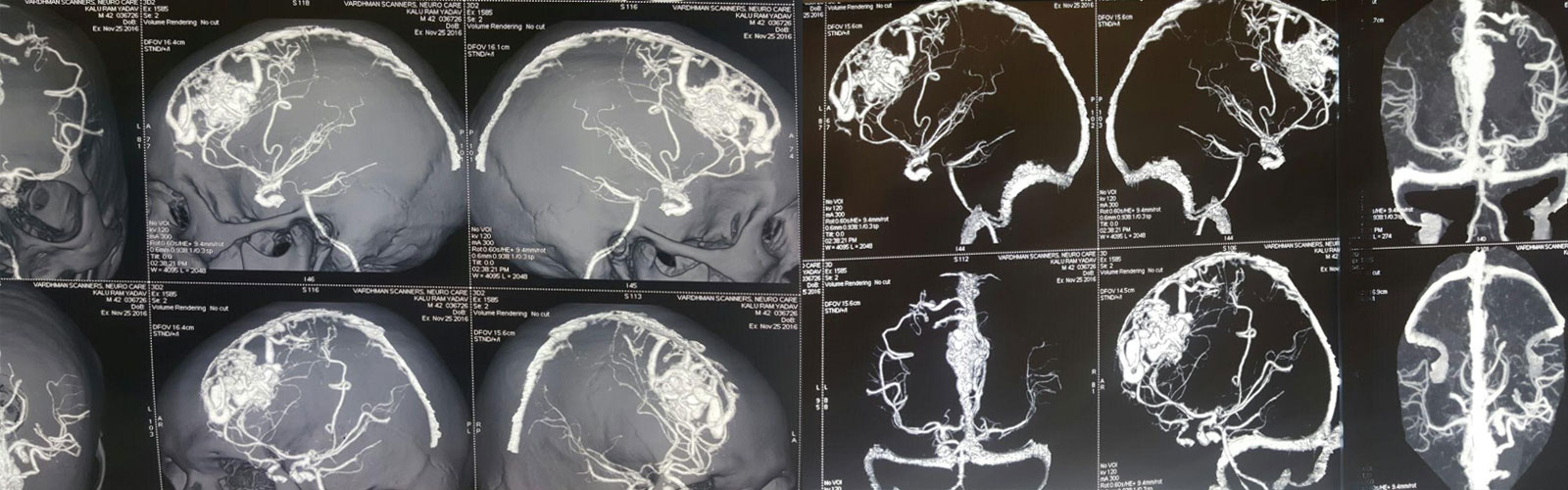 Career at Neuro Care Hospital